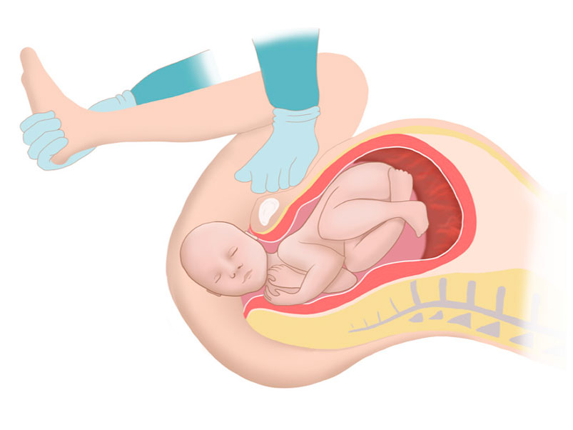 ilustracion matrona